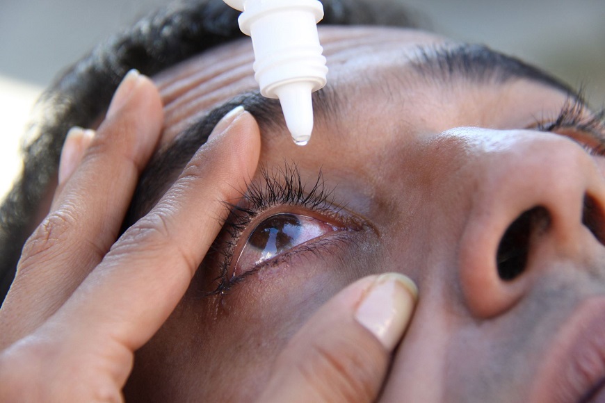 ¿Cómo evitar el contagio de la conjuntivitis?