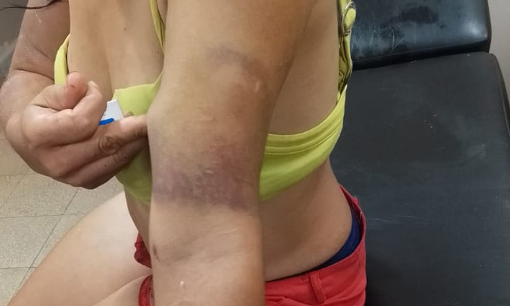 Ordenan detención de hombre acusado de derramar aceite caliente a su pareja