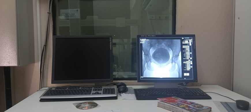 Recuerdan que Hospital de Trauma realiza estudios y procedimientos endovasculares