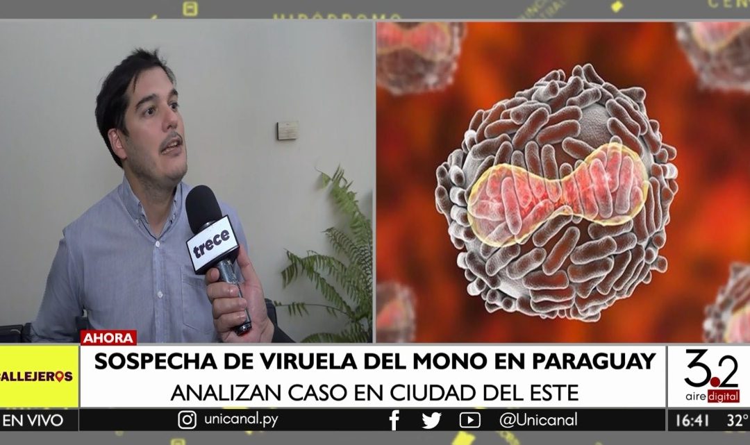 Viruela de mono: “Tarde o temprano vamos a tener casos”, dice Sequera