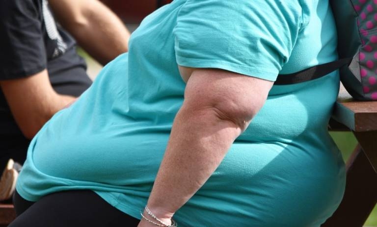 Pacientes con obesidad acceden a cirugías bariátricas en Clínicas