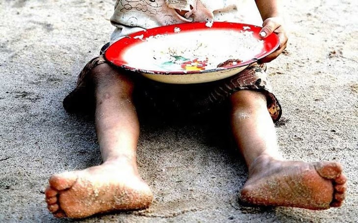 Más de 8 mil niños sufren desnutrición aguda en Venezuela