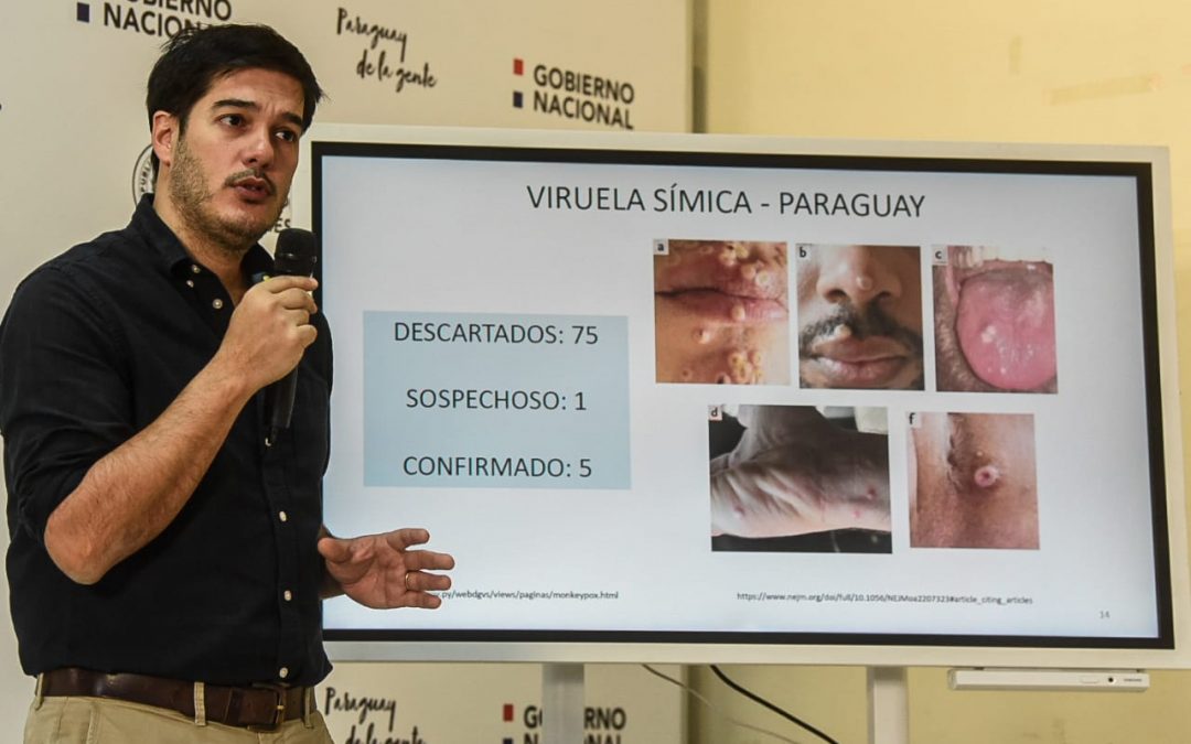 Salud hace llamado de alerta por viruela símica: “La gente tiene vergüenza de ir a consultar”, lamentan