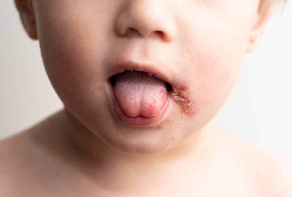 Pediatra insta a no besar a los bebés: “Pueden enfermarlos gravemente”