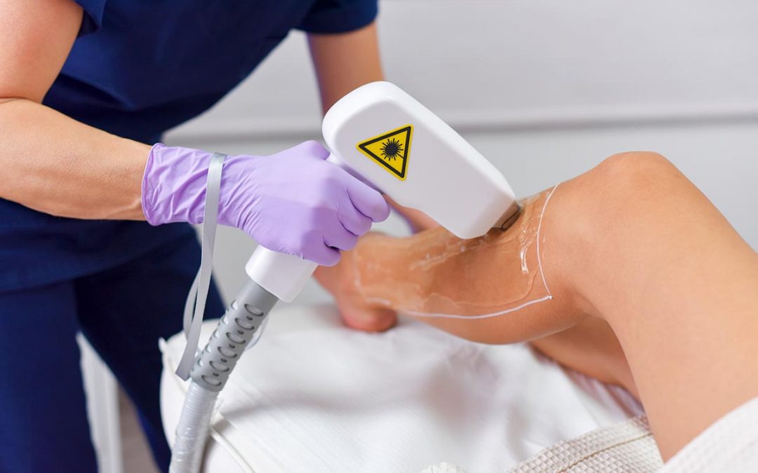 Dermatóloga brinda recomendaciones para iniciar depilación con láser