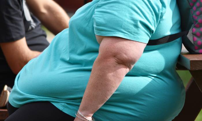 Lucha contra la Obesidad: cada año se registran 2.600 muertes, según Salud