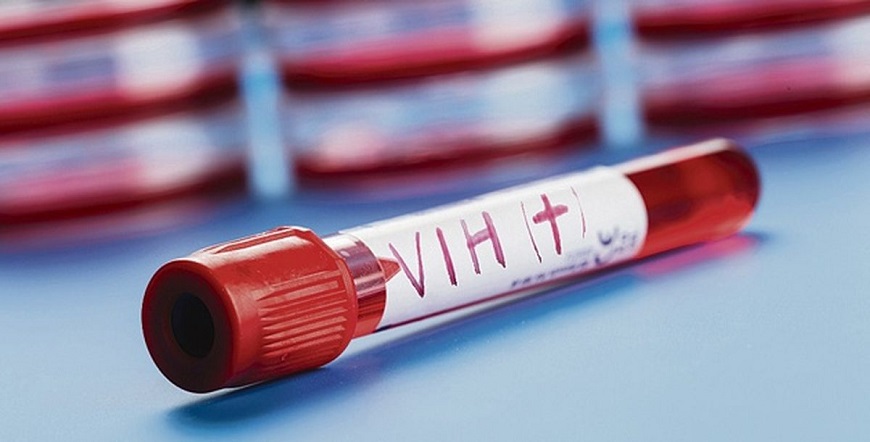 Reportan progresivo aumento de VIH