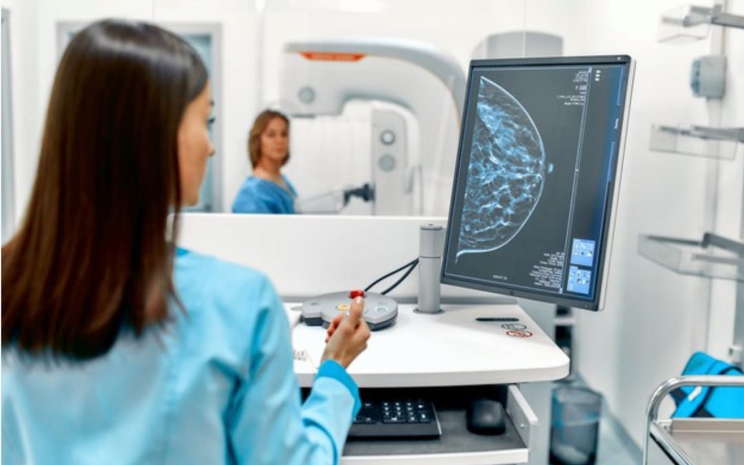 Acceso a mamografías: mujeres de 40 años en adelante podrán realizarse estudio sin orden médica