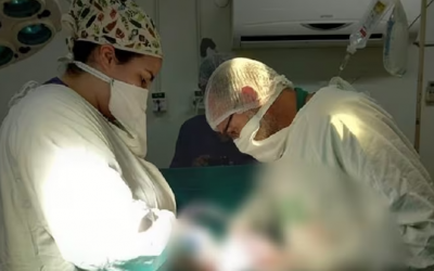 Extraen tumor ovárico de 5 kilos de joven de 22 años en Misiones