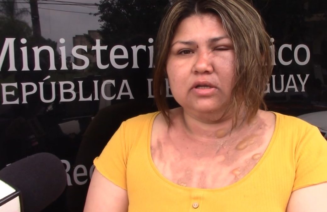 Encarnación: una mujer denunció que le derramaron agua caliente