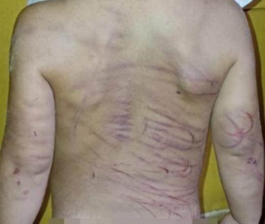 Capturan a joven que habría golpeado con un cable a su pareja e hijastro