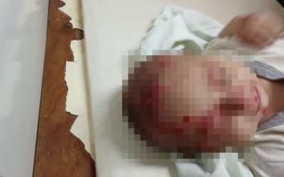 Rescatan a tres niños en estado de abandono: uno de ellos con la oreja agusanada
