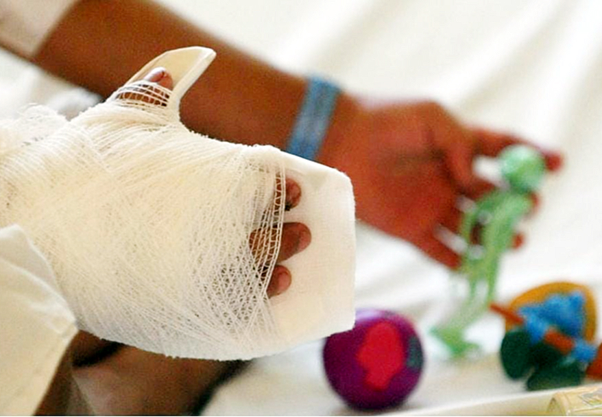 Imputan a padres de niñas que sufrieron quemaduras por petardos